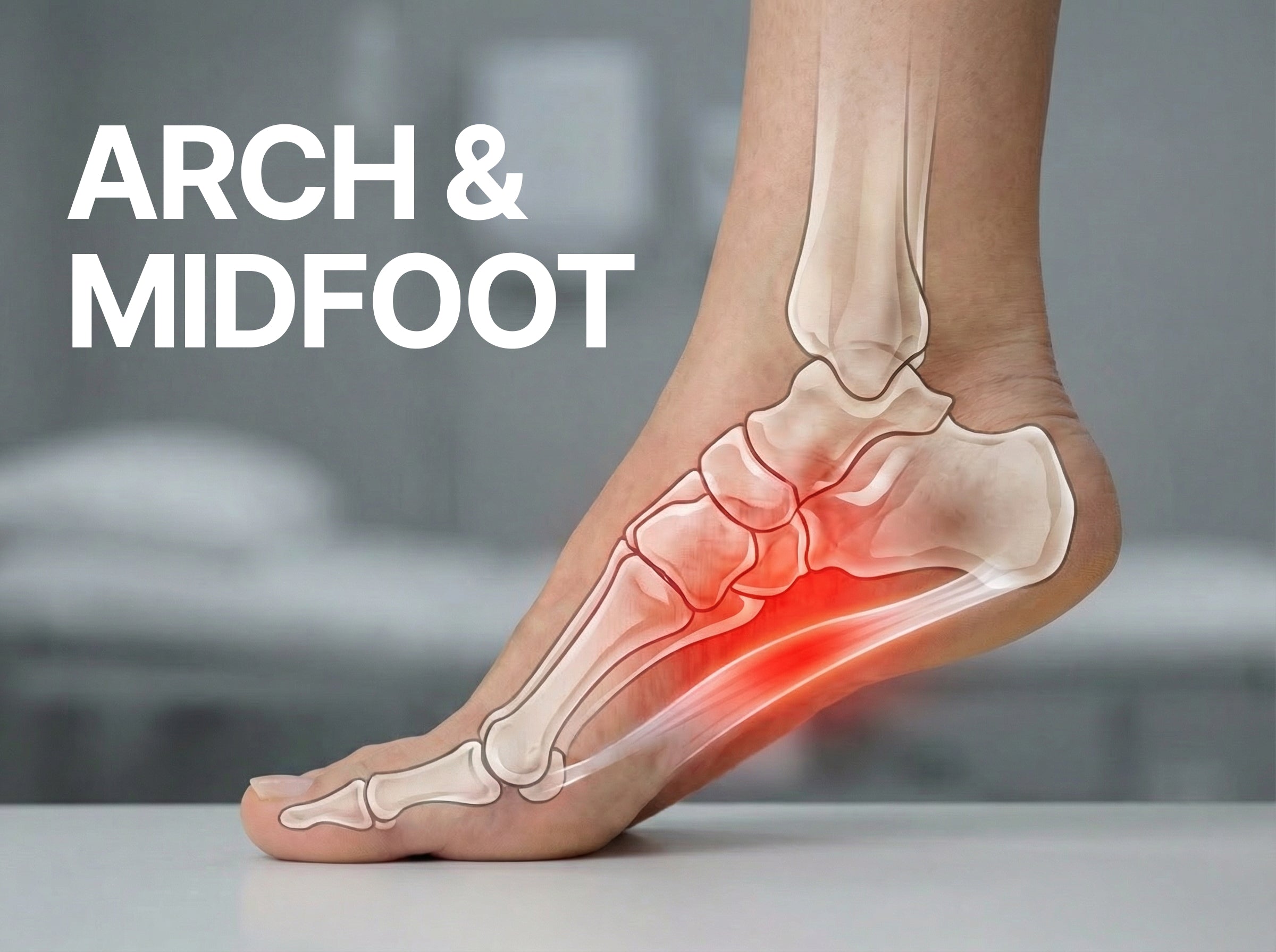Arch & Midfoot - Women's